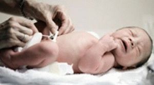 comment traiter une plaie ombilicale