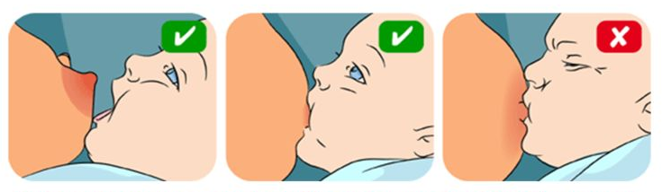 Comment appliquer sur la poitrine