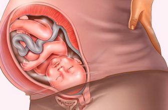 Enceinte de 42 semaines