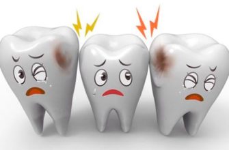 allaitement et caries